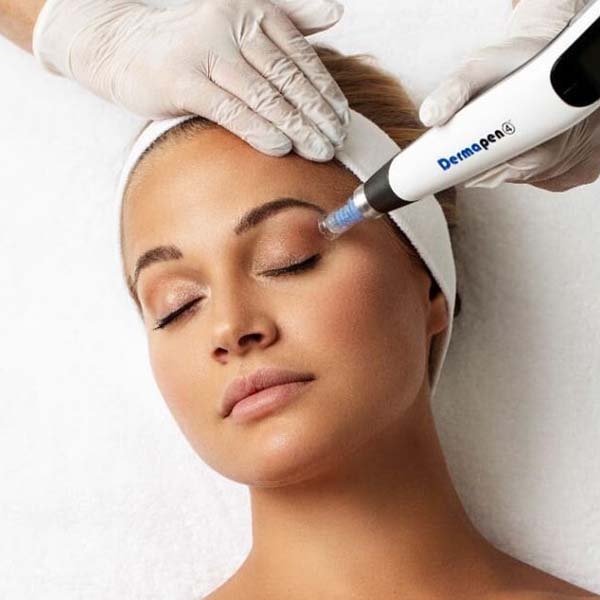 microneedling in sydney at cosmetic injectables by karina