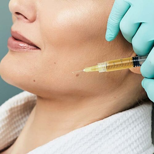 platelet rich plasma (prp) at cosmetic injectables by karina 2